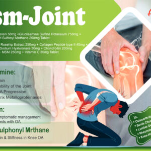 Msm-Joint